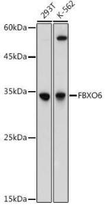 Anti-FbxO6 antibody