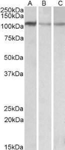 Anti-MTHFD1L Antibody (A84963) (01 µg/ml) staining of NIH3T3 (A), Mouse Brain (B) and Rat Brain (C) lysates (35 µg protein in RIPA buffer) Primary incubation was 1 hour Detected by chemiluminescence