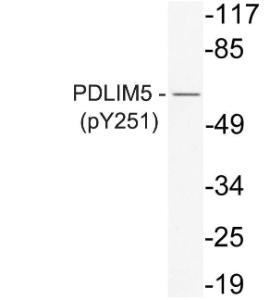 Western blot analysis of lysate from K562 cells using Anti-PDLIM5 (phospho Tyr251) Antibody