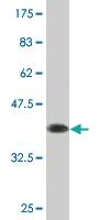 Anti-AHSG Mouse Monoclonal Antibody [clone: 3C9]