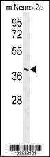 Anti-CASC4 Rabbit Polyclonal Antibody (AP (Alkaline Phosphatase))