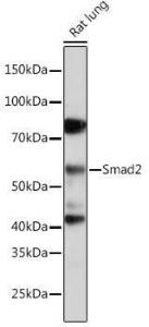 Anti-Smad2 Rabbit Monoclonal Antibody [clone: ARC0343]