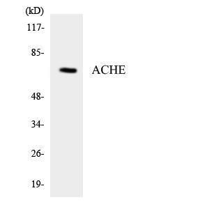 Western blot analysis of the lysates from HT 29 cells using Anti-ACHE Antibody