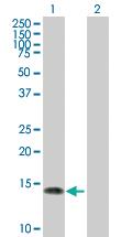 Anti-NGFRAP1 Mouse Polyclonal Antibody