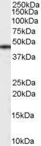 Anti-CSNK1D antibody