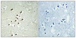 Immunohistochemical analysis of paraffin-embedded human brain using Anti-TUBGCP5 Antibody 1:100 (4°C overnight). The right hand panel represents a negative control, where the antibody was pre-incubated with the immunising peptide.