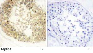 Anti-C2ORF40 Rabbit Polyclonal Antibody