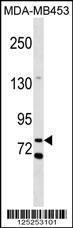 Anti-COL12 Rabbit Polyclonal Antibody (PE (Phycoerythrin))