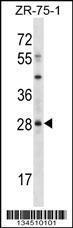 Anti-MSX2 Rabbit Polyclonal Antibody (AP (Alkaline Phosphatase))