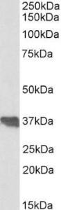 Anti-CLU Antibody (A83344) (0.1µg/ml) staining of Human Colon lysate (35µg protein in RIPA buffer). Primary incubation was 1 hour. Detected by chemiluminescence.