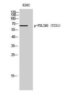 Western blot analysis of K562 cells using Anti-PDLIM5 (phospho Tyr251) Antibody