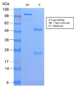 SDS-PAGE analysis of Anti-HLA DP Antibody [HLA-DPB1/2862R] under non-reduced and reduced conditions; showing intact IgG and intact heavy and light chains, respectively. SDS-PAGE analysis confirms the integrity and purity of the antibody.