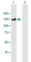 Anti-USP20 Mouse Polyclonal Antibody