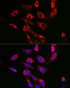 Anti-FbxO6 antibody