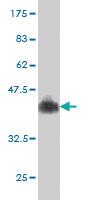 Anti-TMPRSS15 Mouse Monoclonal Antibody [clone: 3F8]