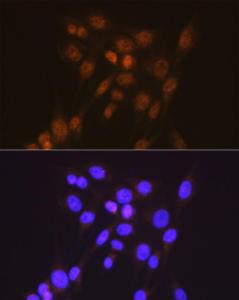 Anti-Smad2 Rabbit Monoclonal Antibody [clone: ARC0343]