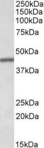 Anti-TFB2M Antibody (A84965) (0.1µg/ml) staining of Human Lung lysate (35µg protein in RIPA buffer). Primary incubation was 1 hour. Detected by chemiluminescence.