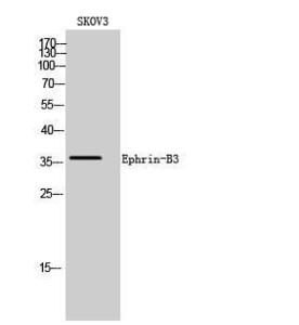 Western blot analysis of SKOV3 cells using Anti-EFNB3 Antibody