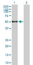 Anti-MMP1 Mouse Polyclonal Antibody