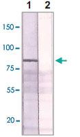 Anti-ESR1 Rabbit Polyclonal Antibody