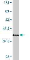 Anti-TFAP2A Mouse Monoclonal Antibody [clone: 3E6]