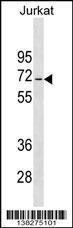 Anti-JRKL Rabbit Polyclonal Antibody (AP (Alkaline Phosphatase))