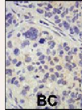 Anti-USP8 Rabbit Polyclonal Antibody