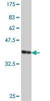 Anti-PHRF1 Mouse Polyclonal Antibody