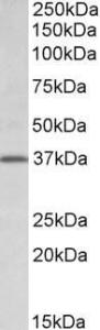 Anti-Tfb2m Antibody (A84966) (0.5µg/ml) staining of Rat Lung lysate (35µg protein in RIPA buffer). Primary incubation was 1 hour. Detected by chemiluminescence.