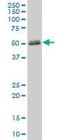 Anti-MMP1 Mouse Polyclonal Antibody