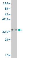 Anti-SMARCA2 Mouse Monoclonal Antibody [clone: 2D12]