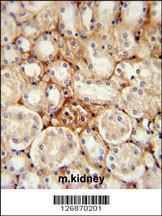 Anti-ATP5J2 Rabbit Polyclonal Antibody (FITC (Fluorescein Isothiocyanate))