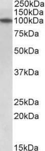 Anti-TXNDC11 Antibody (A84967) (1 µg/ml) staining of Human Thymus lysate (35 µg protein in RIPA buffer). Primary incubation was 1 hour. Detected by chemilu minescence