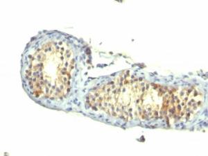 Immunohistochemical analysis of formalin-fixed, paraffin-embedded human testicular carcinoma using Anti-TGF alpha Antibody [1E8-G6]