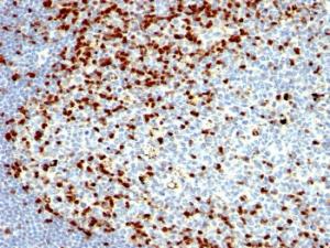 Anti-ZAP70 antibody