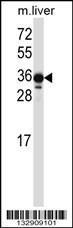 Anti-LIMS2 Rabbit Polyclonal Antibody (APC (Allophycocyanin))