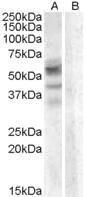 Antibody anti-ARSD A83345-100 100 µg