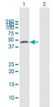 Anti-MMP1 Rabbit Polyclonal Antibody