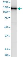 Anti-USP20 Rabbit Polyclonal Antibody