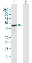 Anti-HEMK1 Rabbit Polyclonal Antibody