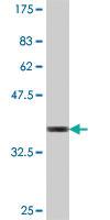 Anti-BBS1 Mouse Polyclonal Antibody