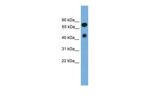 Anti-RIPK4 Rabbit Polyclonal Antibody