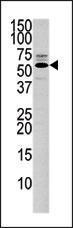 Anti-PTEN Rabbit Polyclonal Antibody (HRP (Horseradish Peroxidase))