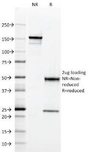 SDS-PAGE analysis of Anti-HLA DQ Antibody [SPV-L3] under non-reduced and reduced conditions; showing intact IgG and intact heavy and light chains, respectively. SDS-PAGE analysis confirms the integrity and purity of the Antibody