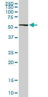 Anti-AGT Rabbit Polyclonal Antibody