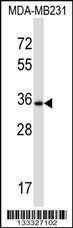 Anti-DTX3 Rabbit Polyclonal Antibody (FITC (Fluorescein Isothiocyanate))