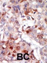 Anti-AKT3 Rabbit Polyclonal Antibody (FITC (Fluorescein Isothiocyanate))