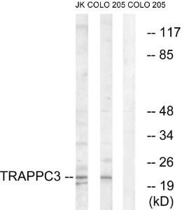 Western blot analysis of lysates from COLO and Jurkat cells using Anti-TRAPPC3 Antibody. The right hand lane represents a negative control, where the Antibody is blocked by the immunising peptide