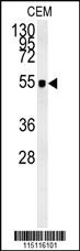 Anti-ZIC3 Rabbit Polyclonal Antibody