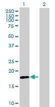 Anti-RNF170 Mouse Polyclonal Antibody